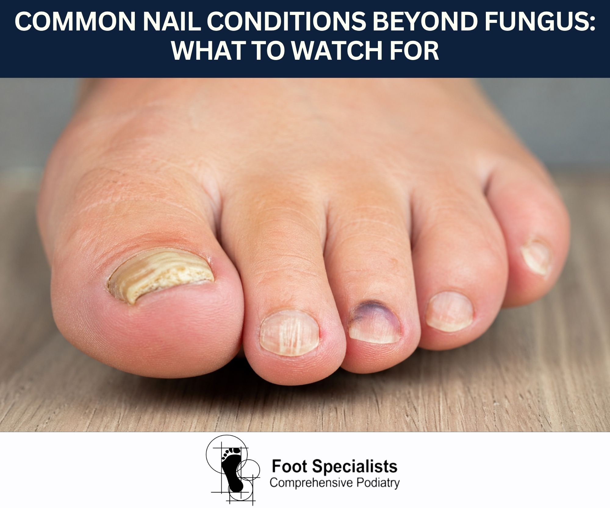 Common Nail Conditions Beyond Fungus: What to Watch For