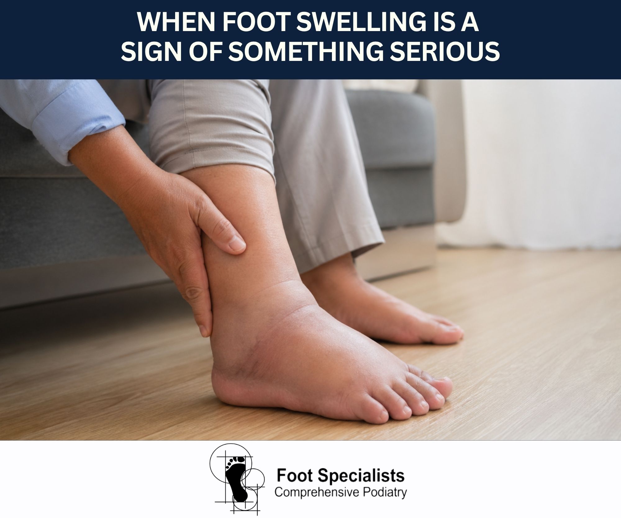 When Foot Swelling Is a Sign of Something Serious